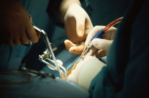 ����STK����������